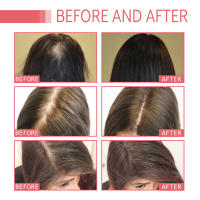 Denso hidrata las raíces, repara el cabello seco y encrespado, previene la caída del cabello y lo fija con aceite esencial. - details 7