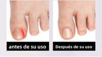 Cortaúñas de Gran Apertura de Acero Inoxidable Juego de Cortaúñas Secundarias Cuchillo de Manicura - details 3
