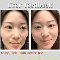 Parche hidrocristalino reafirmante de líneas finas, antienvejecimiento, levantamiento de la flacidez de la piel Facial, mascarillas de nutrición profunda, productos para el cuidado del rostro de Corea - details 6
