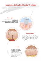 Instrumento de grabado de alambre Introductor de rejuvenecimiento de la piel Eliminación de arrugas faciales Instrumento de radiofrecuencia - details 5