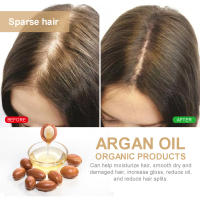 La loción para el cabello densa con aceite de nuez marroquí de Eelhoe previene la caída del cabello, solidifica, suaviza el cabello, nutre, masajea el cuero cabelludo y - details 6