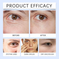 El aceite de esencia de luteína hidrata profundamente la piel alrededor de los ojos. - details 11