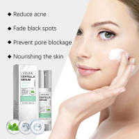 Esencia Facial de Centella Asiatica, suero Facial hidratante que ilumina el cuidado de la piel suave, rejuvenecimiento, refinamiento de poros, rejuvenecimiento - details 10