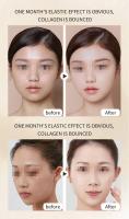 Mini masajeador ultrasónico de mano 7D para estiramiento facial, máquina de belleza para SPA, eliminación de arrugas, antienvejecimiento, estiramiento de la piel, cuidado de los ojos - details 3