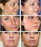 Whitening Freckle Cream Face Brightening Cream Niacinamide Reduce Chloasma Melasma Melanin Fade Fine Lines Lighten Dark Skincare - details 8
