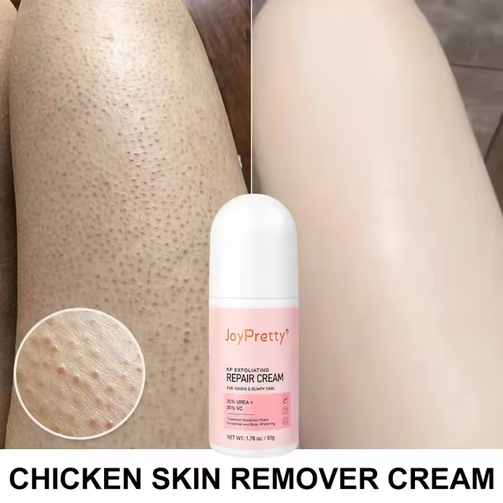KP loción corporal blanqueadora, eliminador de piel de pollo, tratamiento de queratosis pilaris, crema hidratante de poros suave y áspero, crema corporal para el cuidado de la piel - 1