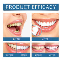 Kit de reparación dental para blanquear, eliminar manchas negras, dientes amarillos y limpiar con esponja - details 10