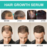 Jayswing Dense Essence repara, hidrata, cabello seco y encrespado, previene el cuidado del cabello para un cabello fuerte, firme y grueso. - details 7