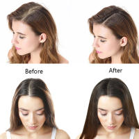 Masajeador eléctrico para el cuero cabelludo y la cabeza, aplicador líquido de medicina para el crecimiento del cabello, peine de aceite esencial, terapia de luz roja infrarroja, anticaída del cabello - details 7