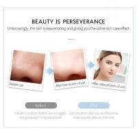 Máquina de pala de belleza ultrasónica - details 9