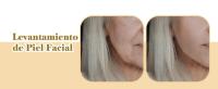 Masajeador Facial, Antiedad LED Luz Roja Terapia Masajeador Cara, Máquina Facial para Antiarrugas y Reafirmante, Rejuvenecimiento Facial, Cuidado Facial - details 7