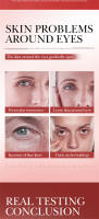 Crema para ojos para eliminar arrugas instantáneas, colágeno, elimina las líneas finas, bolsas para los ojos, antihinchazón, humectante reafirmante, cuidado de los ojos - details 2