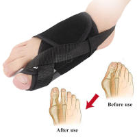 EiD-almohadillas de Gel para el cuidado de Hallux Valgus, calcetín ortopédico para juanete, separador de dedos, corrección del dolor de pies, insertos de manga para aliviar el dolor, hombre y mujer - details 22
