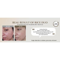 Tónico facial de arroz que reabastece el brillo, cuidado hidratante coreano para pieles grasas y mixtas - details 1