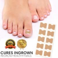 Pegatinas de corrección de uñas encarnadas, parches correctores para tratamiento de paroniquia, herramientas de pedicura, 10/20 piezas - details 0