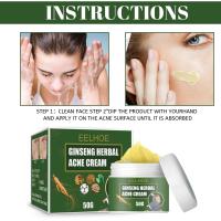 EELHOE-crema de tratamiento de Ginseng a base de hierbas, Reduce las cicatrices, Control de aceite, hidratante, reduce los poros naturales, loción facial para el acné - details 5