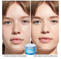 Crema de Gel de ácido hialurónico, crema hidratante Facial para hidratar y suavizar la piel Extra seca, nutritiva, mejora la sequedad, loción Facial - details 15
