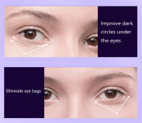 Masajeador de Ojos de terapia de luz roja EMS, compresa caliente, elimina las ojeras, relaja los ojos cansados, antiarrugas, estiramiento facial, cuidado de los ojos, varita de belleza - details 6