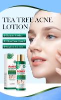 Loción para el acné del árbol del té, cuidado facial antiacné, crema hidratante de día y de noche para mujeres y hombres - details 0