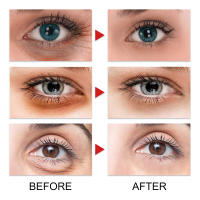 Crema para los Ojos Jaysuing Peptido Tratamiento Antiedad, Anti-arrugas, Adiós a las Ojeras y Hinchazón Herramientas de Cuidado de la Piel Facial de Belleza - details 5