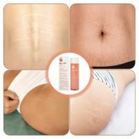 Los aceites esenciales biológicos suaves y no irritantes previenen y desvanecen las cicatrices de la obesidad durante el embarazo - details 4