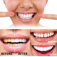 Jayswing Gel Tooth Fresh Breath Limpieza bucal - details 8