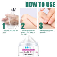 Crema para cicatrices aclara las estrías, los bultos de grasa y las cicatrices, hidratando la piel. - details 3
