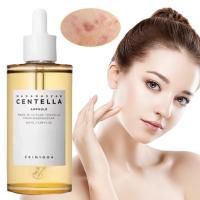 Centella Asiatica ampolla esencia hidratante alivia la inflamación de la piel calmante suave alivia la sequedad cuidado de la piel Facial - details 1