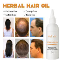 La planta herbaria repara la furia seca, hidrata, suaviza el cuidado y el aceite para el cabello denso - details 5