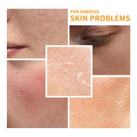 Set de cuidado de la piel con vitamina C, set de 6 piezas que incluye sérum tonificante, crema facial para ojos, protector solar, limpiador, hidratante profundo para la piel - details 2