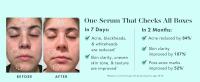face moisturizer hydrating acne skincare skin moisturizers