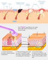 Máquina Facial de alta frecuencia, herramientas para el acné, masajeador Facial, cuidado de la piel, Spa de belleza para el cabello - details 2