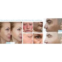 face lift device