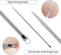 Herramientas de Maquillaje DUcare 4PCS Extractor de Acné y Espinillas de Acero Inoxidable Limpiador de Piel Facial para Todo Tipo de Piel - details 6