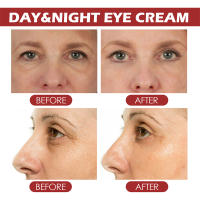 Crema de Ojos de Retinol Serum para Ojos de Anti-envejecimiento para Lifting Facial Hidratante - details 11