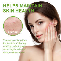 Aceite esencial de árbol de té para reparar el cabello, hidratante para la piel Facial, esencia para uñas grises hidratante y reparadora - details 6