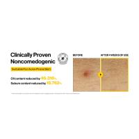 Noncomedogenic