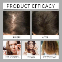 HOEGOA Esencia Nutritiva para Cabello Suave y Brillante, Cuidado del Cuero Cabelludo, Ligeramente Hidratante - details 9