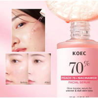 Sérum Facial Coreano Niacinamida Ilumina la Piel, Rejuvenece, Hidrata, Blanquea, Desvanece Manchas y Líneas Finas Herramienta de Cuidado de la Piel de Belleza - details 24