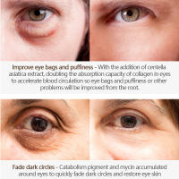 VEZE nicotinamida crema para ojos elimina las bolsas de los ojos ojeras debajo de los ojos ácido hialurónico suero hidratante para ojos hinchazón cuidado de la piel - details 5