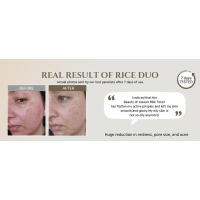 Tónico facial de arroz reabastecedor de brillo Beauty of Joseon para piel mixta grasa, cuidado coreano hidratante y equilibrante 150ml - details 1