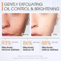 Limpiador Facial de Ácido Salicilico Control de Aceite Anti-Acné Blanqueador de Piel Suave - details 9
