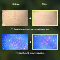 Esencia Antioxidante Anua Limpiador Facial Hidratante Emulsión para Rejuvenecer la Piel - details 27