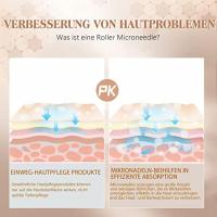 Rodillos de microagujas para la cara, Kit de rodillos Derma de titanio para piel sedosa y hermosa para jóvenes, microagujas - details 2