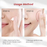 Crema blanqueadora para pecas, niacinamida, crema para la piel, brillo, hidratación de la piel, mejora la piel opaca, Control de aceite, eliminador antiacné, 20g - details 1