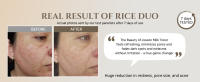 rice MASK
