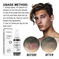 El spray antipérdida mejora la densidad de la línea del cabello, fortalece el cabello, nutre el cuero cabelludo e hidrata el cabello. - details 3