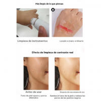 Limpiador facial de silicona Cepillo facial recargable resistente al agua Limpiador de poros 4 en 1 Limpiador facial eléctrico - details 11