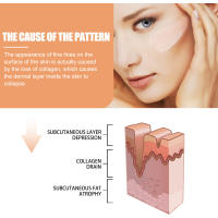 Bálsamo múltiple para rebote de arrugas, crema facial hidratante brillante que se desvanece, líneas finas, estiramiento, estiramiento, barra de colágeno, Cosméticos Coreanos - details 5