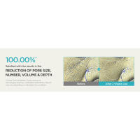 ANUA BHA 2% Tónico exfoliante suave, exfoliante facial suave, ácido salicílico para poros y sebo, extracto de árbol de té, hialurónico - details 4